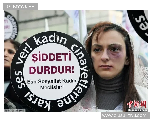 德国球迷组织警告加强球场安全措施可能引发更大规模抗议活动